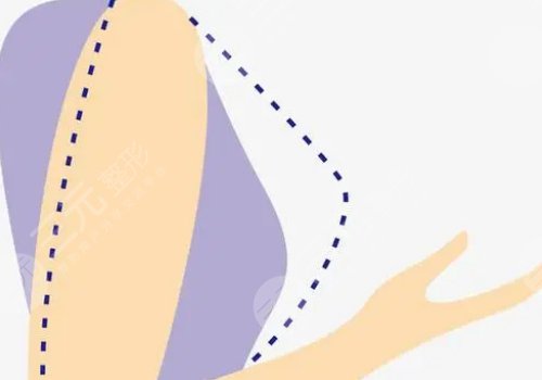 深圳阳光医院陈星光医生