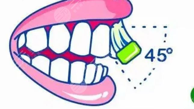 牙齿矫正刷牙