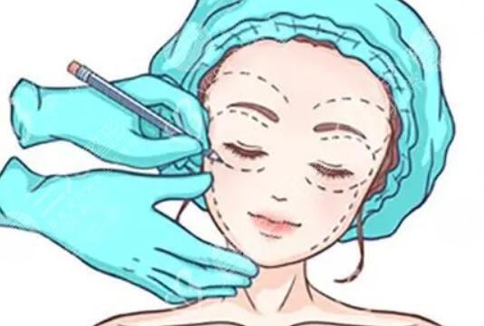 轮廓针