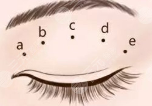广州可玉医疗美容医院罗勇怎么样？