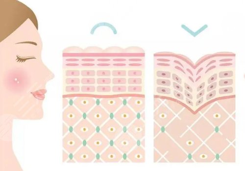 双美胶原蛋白有几种型号？