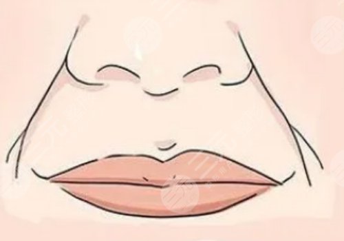 括号纹怎么去掉？怎么形成的？改良方式解读！