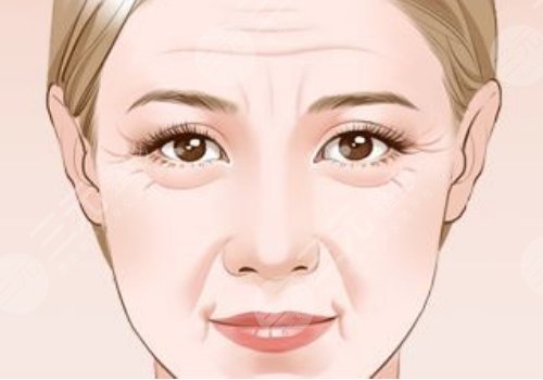 括号纹怎么去掉？怎么形成的？改良方式解读！