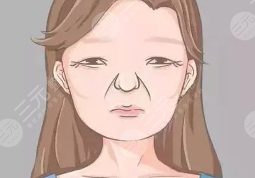 括号纹怎么去掉？怎么形成的？改良方式解读！