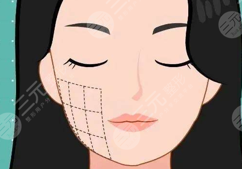 口周抗衰包括哪些项目?
