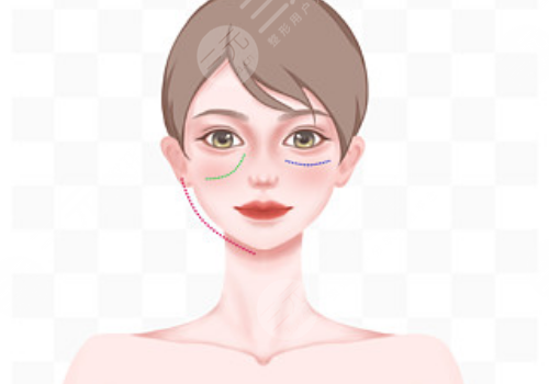 动态纹和静态纹的区别