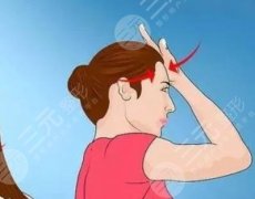 水剥离拉皮手术可以维持多久?一般3-5年,具体维持效果因人而异! 水剥离拉皮手术可以维持多久?一般3-5年,具体维持效果因人而异!