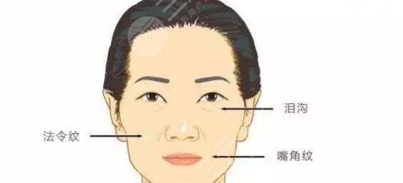 面部填充