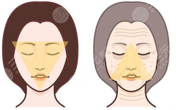 拉皮手术的实际效果如何?