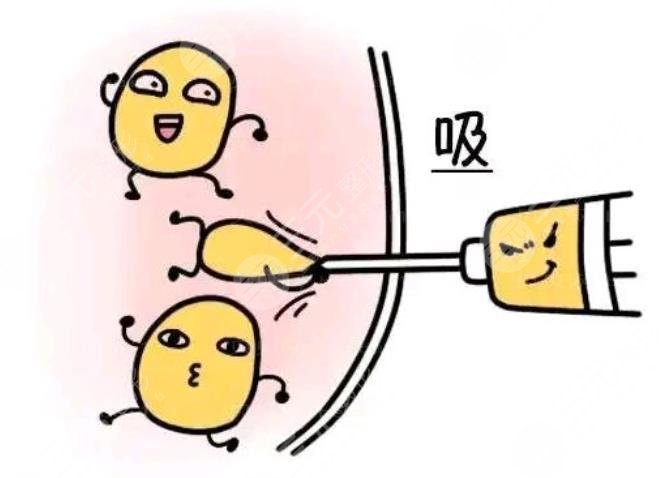 卢新蕾吸脂手术案例