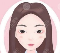 眼周小拉皮是怎么样做的?操作基本信息解答、六大注意事项科普! 眼周小拉皮是怎么样做的?操作基本信息解答、六大注意事项科普!
