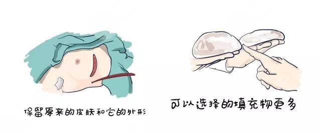 孔庆颂医生隆胸案例
