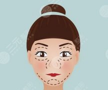 做轮廓固定需要多少钱一次？价格范围参考|轮廓固定原理科普！