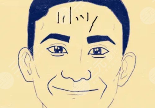 抬头纹怎么去除有效男生？