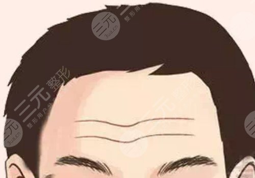 抬头纹怎么去除有效男生？