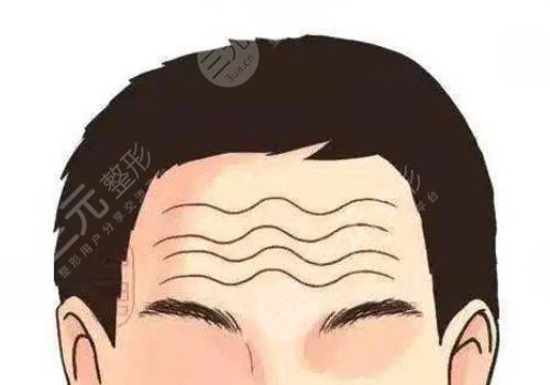 抬头纹怎么去除有效男生？