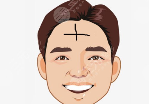 抬头纹怎么去除有效男生？