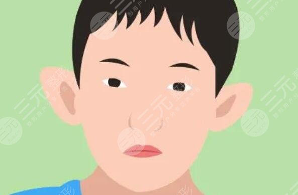 招风耳