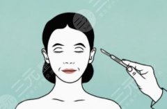 拉皮整形手术后恢复过程介绍!除皱抗衰,你应该知道的3件事! 拉皮整形手术后恢复过程介绍!除皱抗衰,你应该知道的3件事!