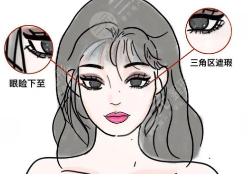 眼尾下垂怎么办怎么能提上去