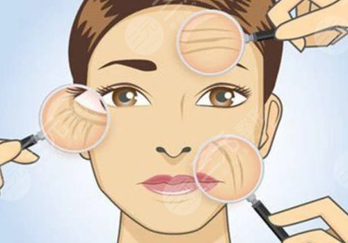 抬头纹去除手术需要多少钱?