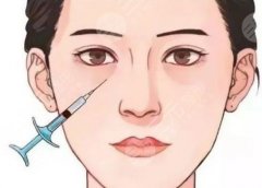 濡白天使适合打泪沟吗？眼部条件合适就可以使用哦、相关知识科普