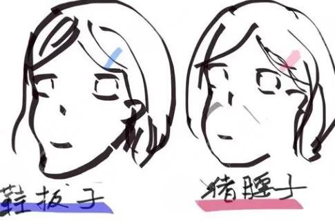 李海翠 鞋拔子脸要怎么整形