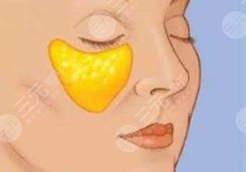 眼窝凹陷用什么填充好？