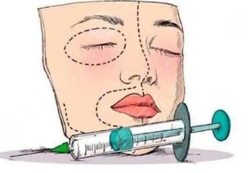 玻尿酸填充下巴有什么副作用？