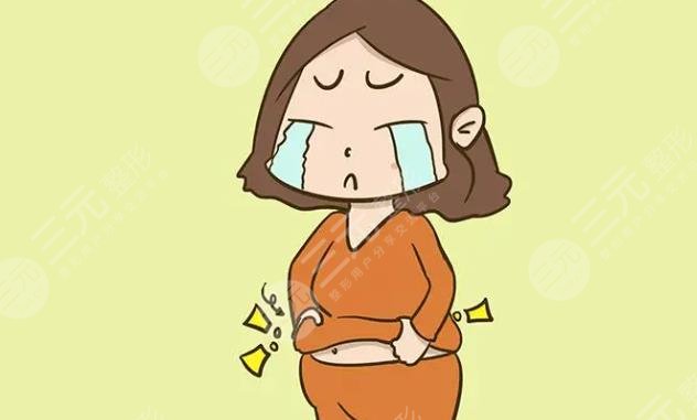 腹壁整形