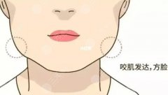 咬肌大脸颊凹陷脸下垂做什么整形？精致脸型塑造指南！
