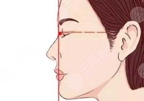 下颌线提升前后对比图