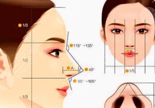 外轮廓固定内轮廓填充的区别