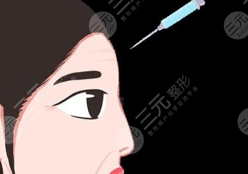 液态轮廓固定