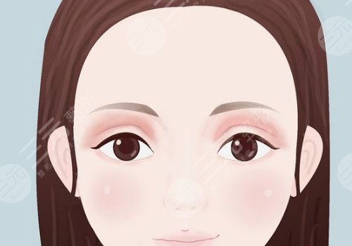 梁志为医生做双眼皮怎么样?