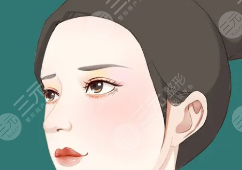 胶原蛋白填充太阳凹大概多少钱？