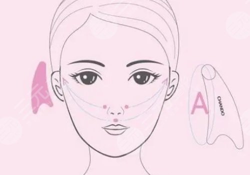 轮廓固定提升多少钱做一次好？