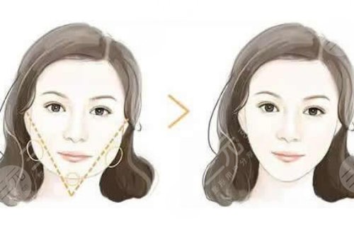 深圳美莱张华彬和黄海龙谁技术好？