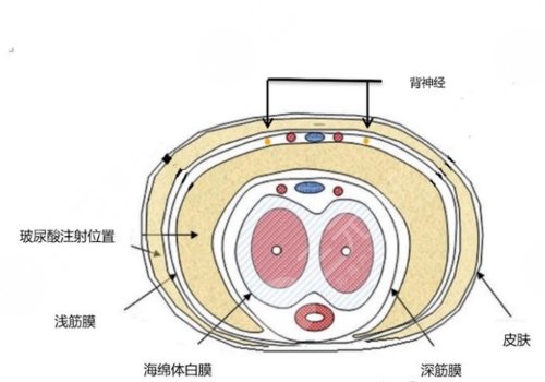 玻尿酸男性增大注射要多少钱？
