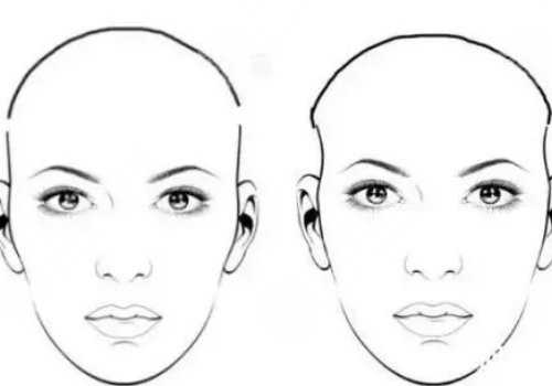 假体填充太阳凹大概多少钱？