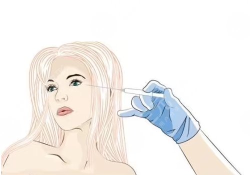 玻尿酸填充太阳凹大概多少钱？