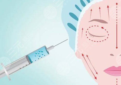 玻尿酸轮廓固定提升能保持多久呢？