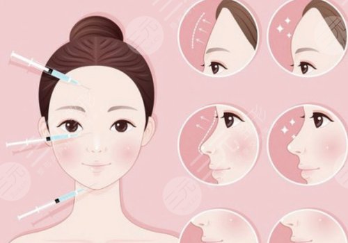 玻尿酸轮廓固定提升能保持多久呢？