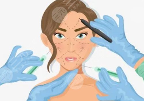 玻尿酸轮廓固定提升能保持多久呢？