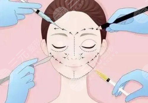 玻尿酸轮廓固定提升能保持多久呢？