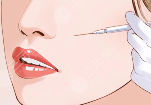 面颊凹陷用什么玻尿酸填充好?中分子还是大分子?