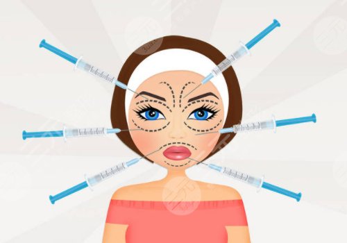 面颊凹陷用什么玻尿酸填充好?