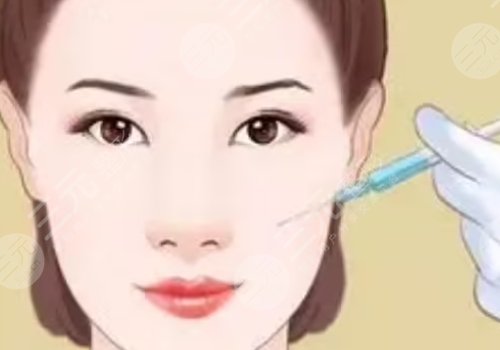 面颊凹陷用什么玻尿酸填充好?