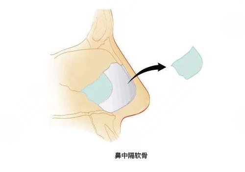 靳玉彪做的鼻子怎么样？
