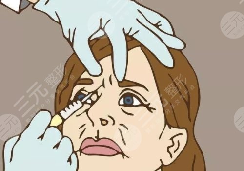 面部打玻尿酸哪里危险大?